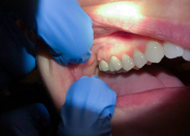 Best After-Hours Emergency Dentist in Liberty, SC