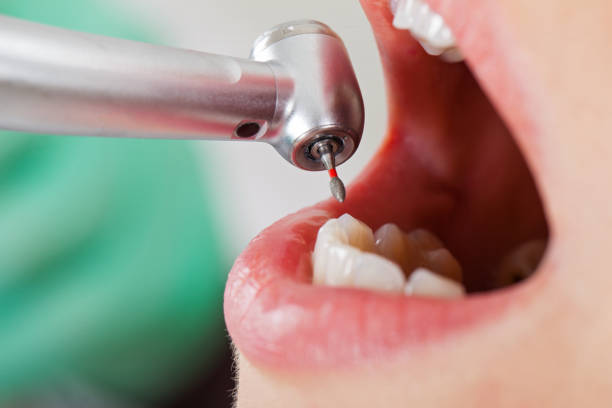 Best Emergency Treatment for Toothache in Liberty, SC